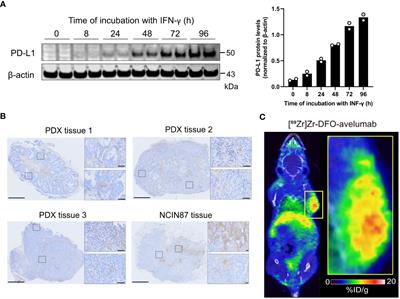 PD-L1 has a heterogeneous and dynamic expression in gastric cancer with implications for immunoPET